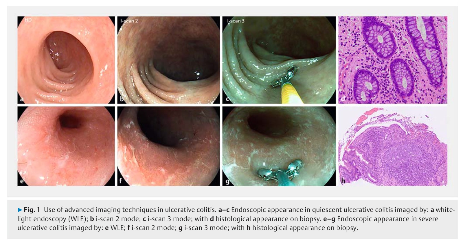 Endoscopic tissue.jpg