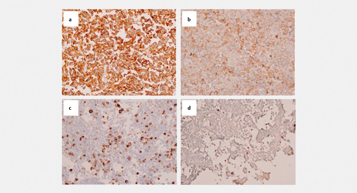 Effect of Cabergoline.jpg