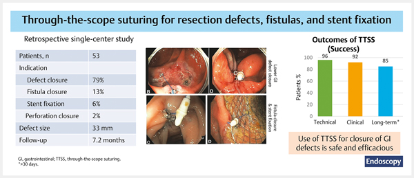 Endoscopic management.jpg