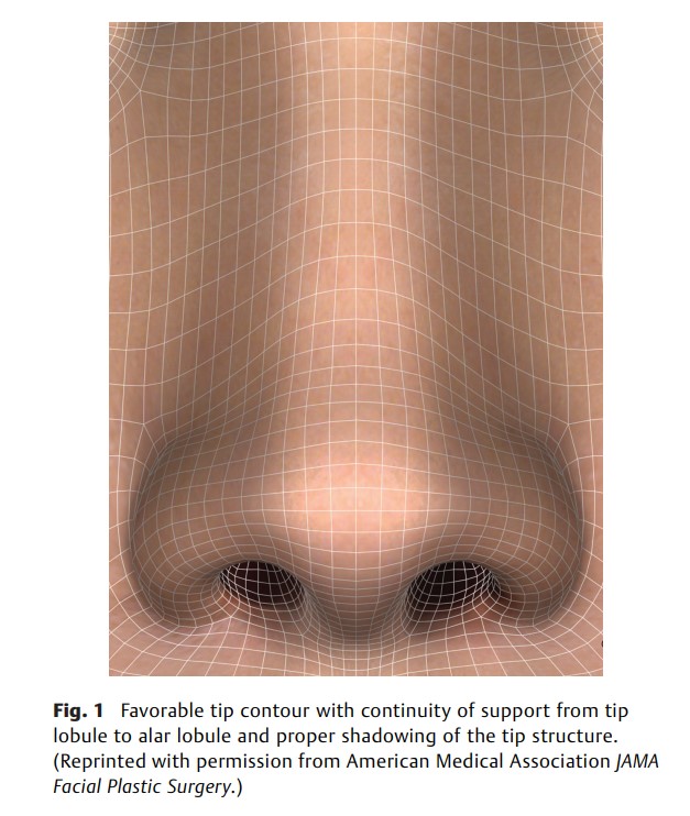 Lateral Crural Repositioning.jpg