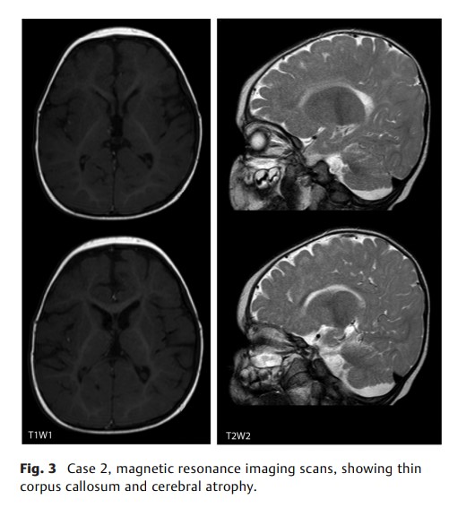 First Clinical Report of Two.jpg