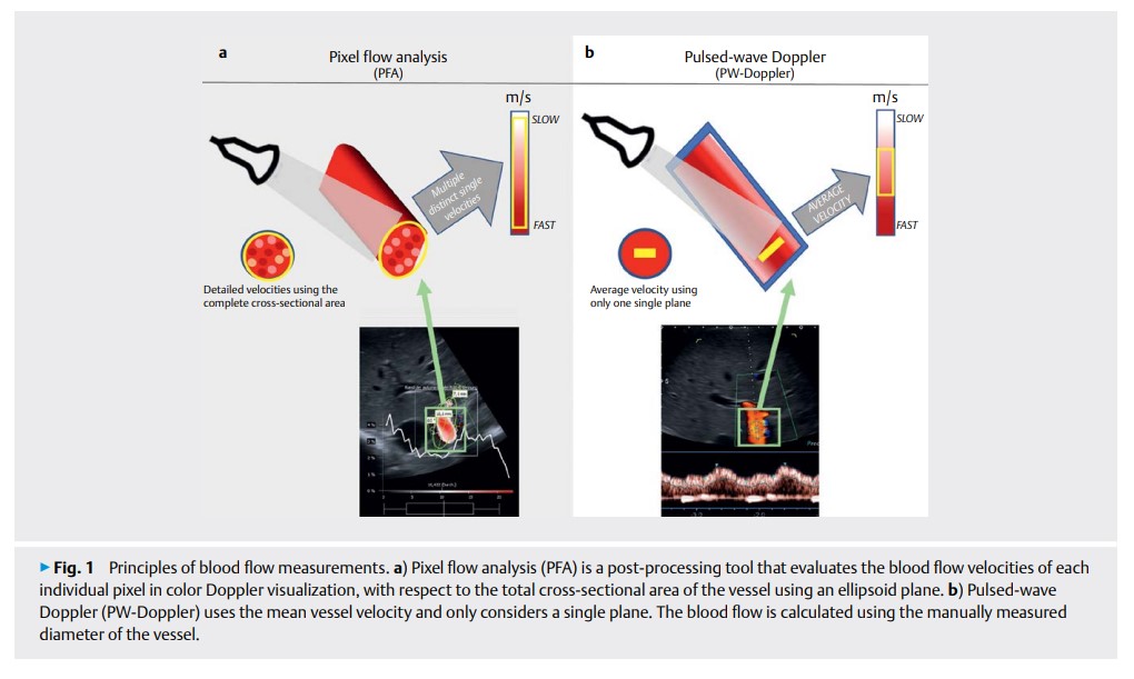 Quantification of Portal.jpg