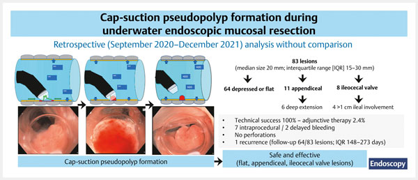 Underwater cap-suction pseudopolyp.jpg