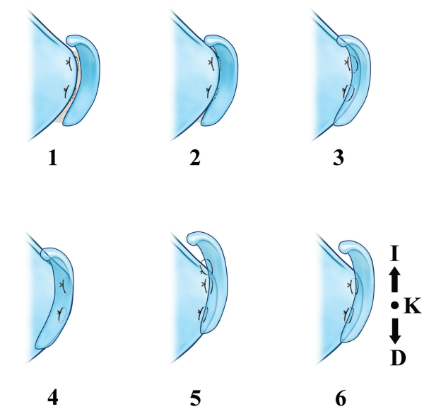 Standardizing Septocolumellar.png