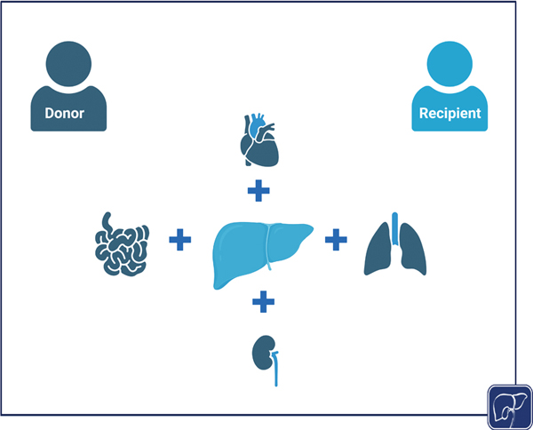 8-Combined Organ Transplantation.jpg